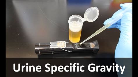 refractometer urine specific gravity principle|specific gravity dipstick vs refractometer.